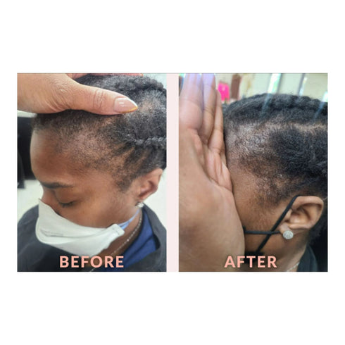 DESIGN EDGE & TEMPLE STRENGTHENING OIL 4 OZ (BIOTIN & BLACK CASTOR OIL)(DES00547)